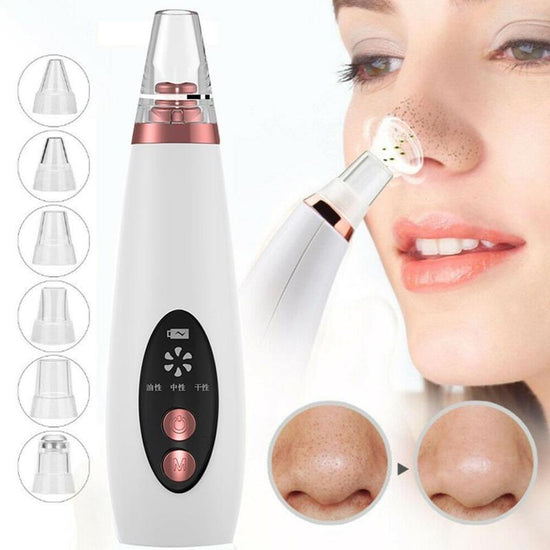 Aspirateur de Points Noirs | Blackhead Vacuum Remover